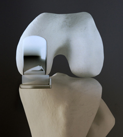 Biomet Oxford Partial Knee Replacement